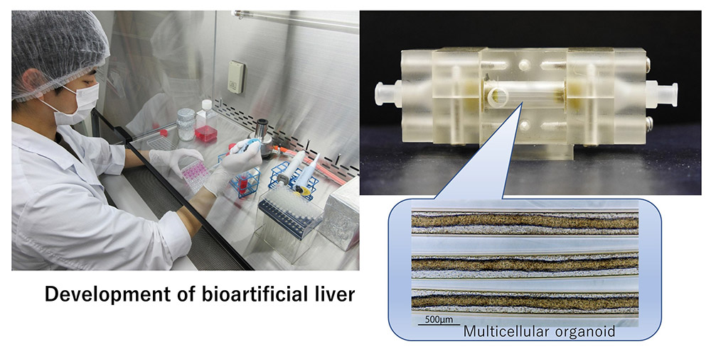 Development of bioartificial liver